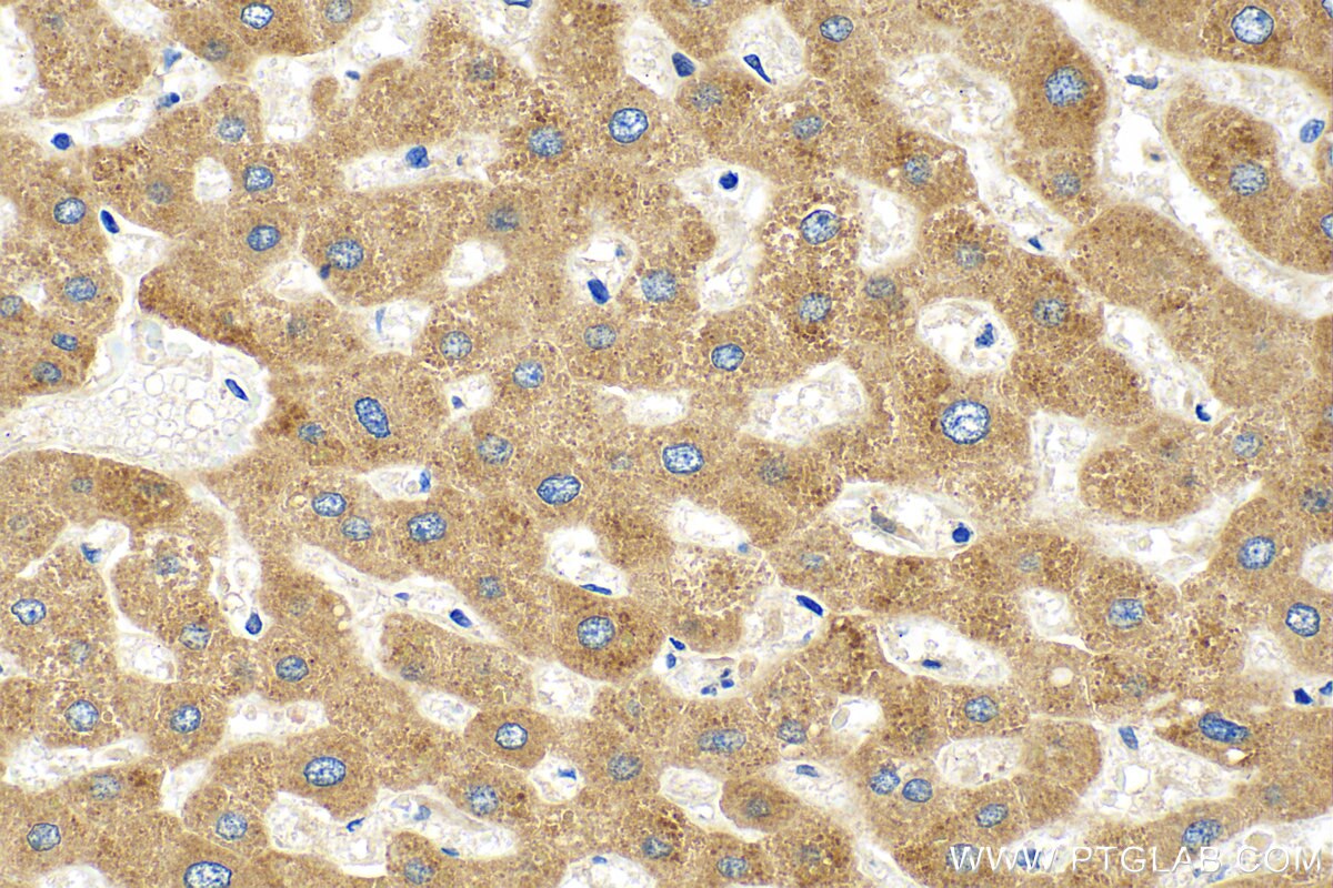 Immunohistochemistry (IHC) staining of human liver tissue using CNPY2, MSAP Polyclonal antibody (14635-1-AP)
