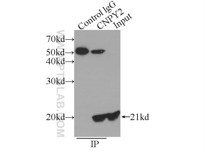 Immunoprecipitation (IP) experiment of HepG2 cells using CNPY2, MSAP Polyclonal antibody (14635-1-AP)