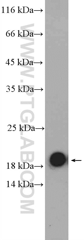 Western Blot (WB) analysis of mouse pancreas tissue using CNPY2, MSAP Polyclonal antibody (14635-1-AP)