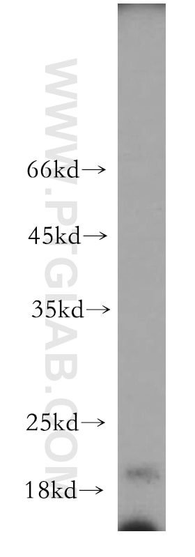 Western Blot (WB) analysis of human liver tissue using CNPY2, MSAP Polyclonal antibody (14635-1-AP)