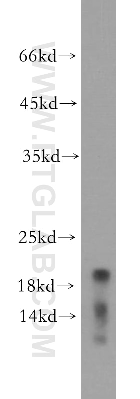 Western Blot (WB) analysis of mouse pancreas tissue using CNPY2, MSAP Polyclonal antibody (14635-1-AP)