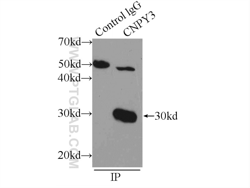 Immunoprecipitation (IP) experiment of mouse kidney tissue using CNPY3 Polyclonal antibody (15215-1-AP)