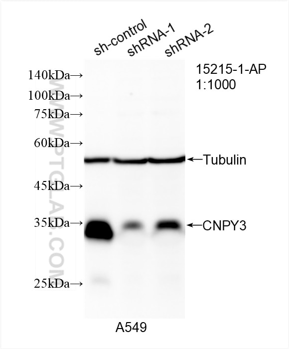 Western Blot (WB) analysis of A549 cells using CNPY3 Polyclonal antibody (15215-1-AP)