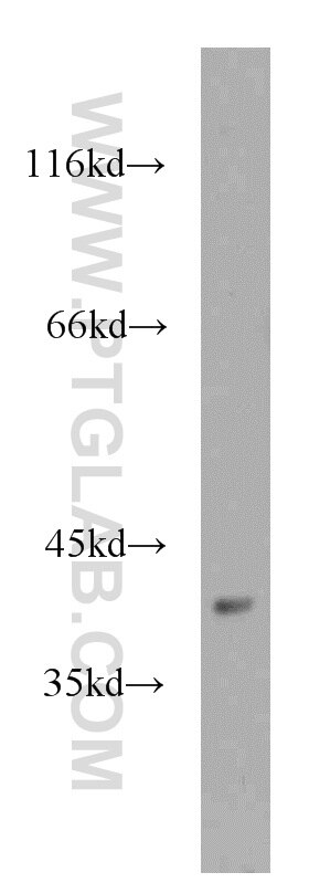 Western Blot (WB) analysis of Jurkat cells using CNPY3 Polyclonal antibody (15215-1-AP)