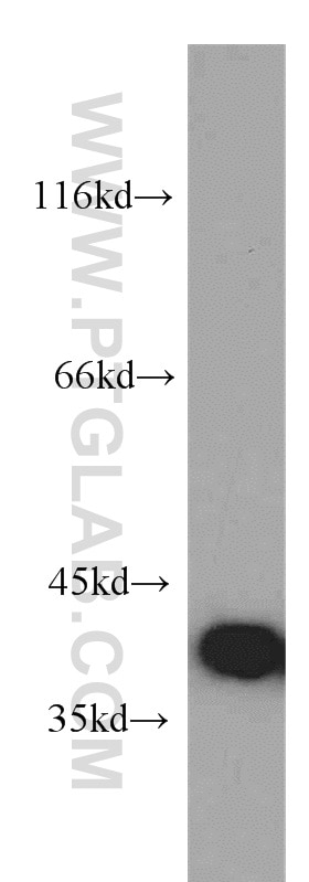 Western Blot (WB) analysis of human brain tissue using CNPY3 Polyclonal antibody (15215-1-AP)