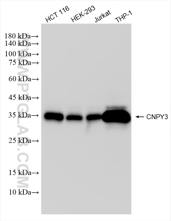 Western Blot (WB) analysis of various lysates using CNPY3 Recombinant antibody (86256-2-RR)
