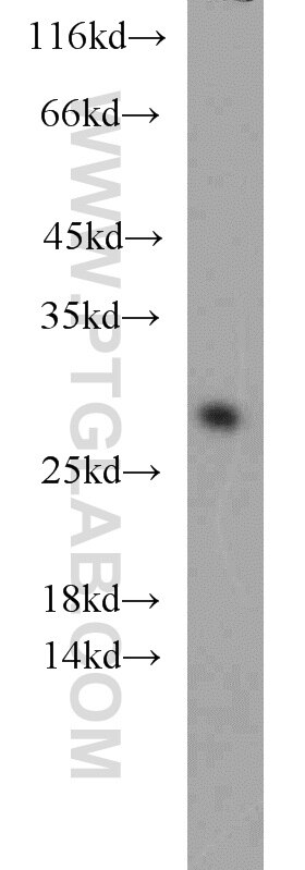 Western Blot (WB) analysis of HeLa cells using CNPY4 Polyclonal antibody (22086-1-AP)