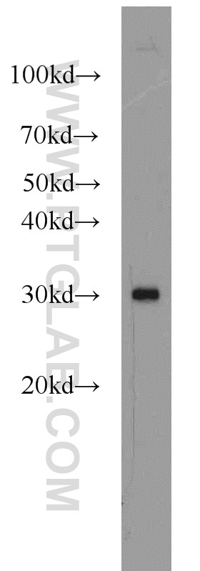 Western Blot (WB) analysis of HeLa cells using CNPY4 Polyclonal antibody (22086-1-AP)