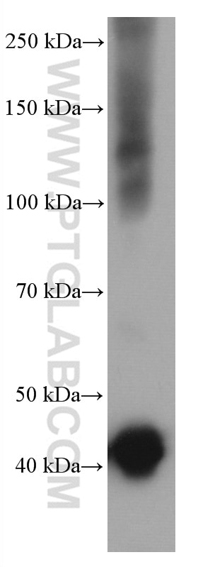 Western Blot (WB) analysis of human brain tissue using CNPase Monoclonal antibody (66729-1-Ig)