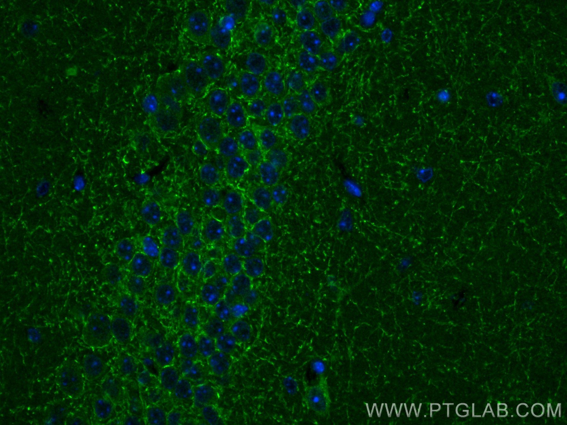 Immunofluorescence (IF) / fluorescent staining of mouse brain tissue using Cannabinoid receptor 1 Polyclonal antibody (17978-1-AP)
