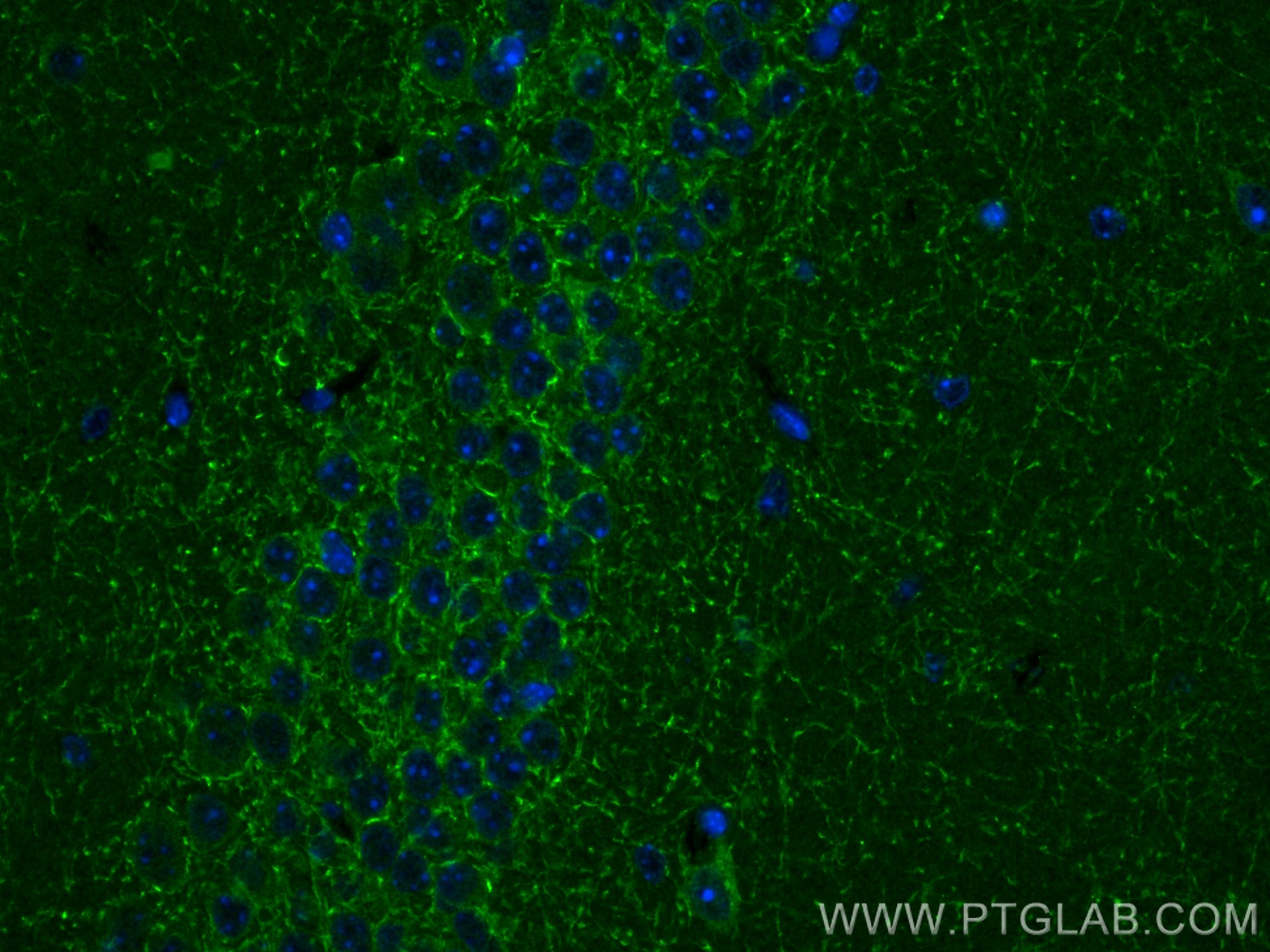 Immunofluorescence (IF) / fluorescent staining of mouse brain tissue using Cannabinoid receptor 1 Polyclonal antibody (17978-1-AP)