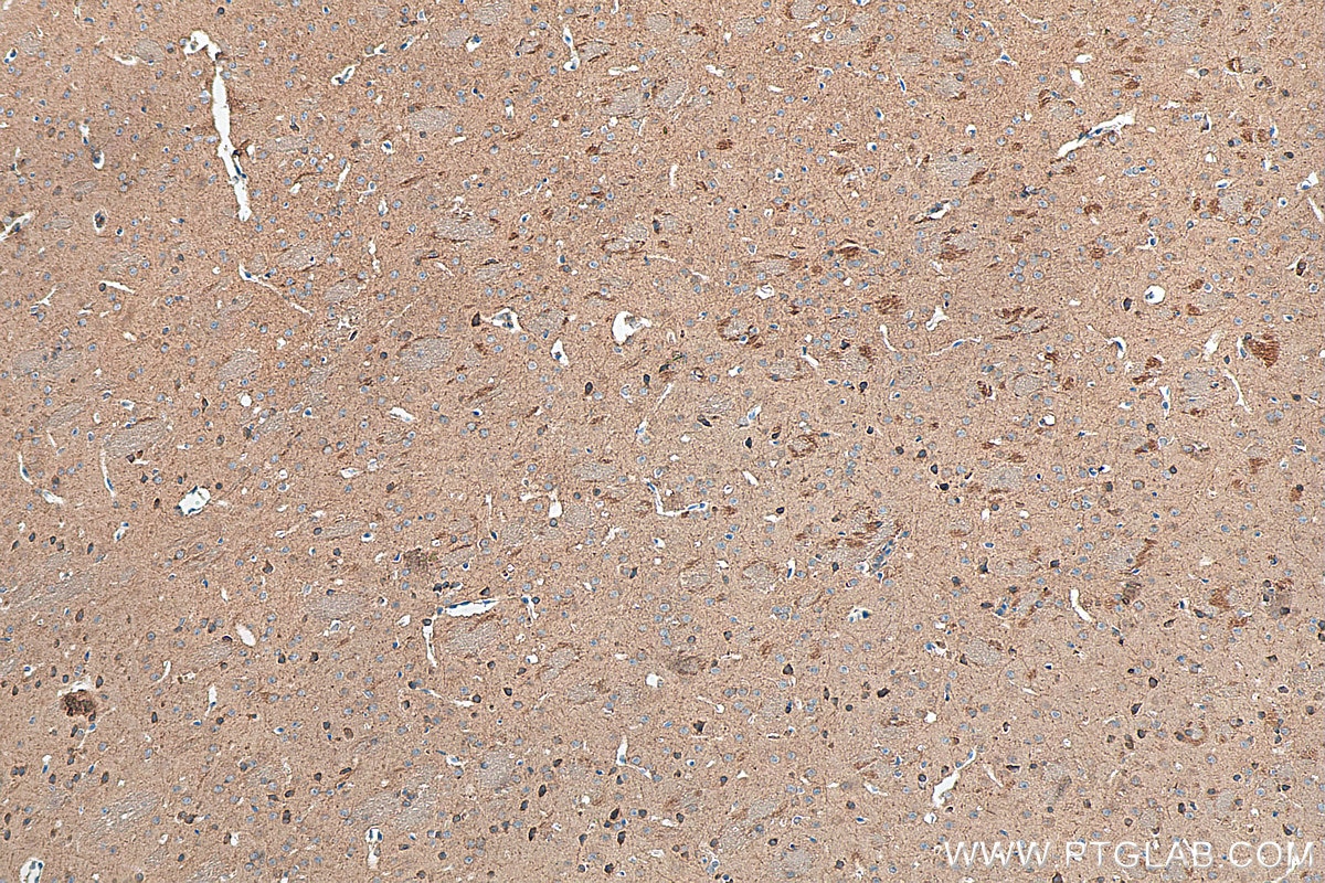 IHC staining of mouse brain using 17978-1-AP