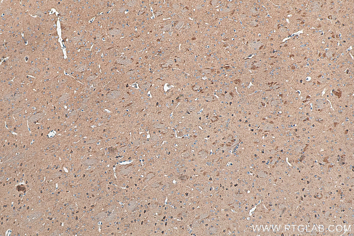 Immunohistochemistry (IHC) staining of mouse brain tissue using Cannabinoid receptor 1 Polyclonal antibody (17978-1-AP)