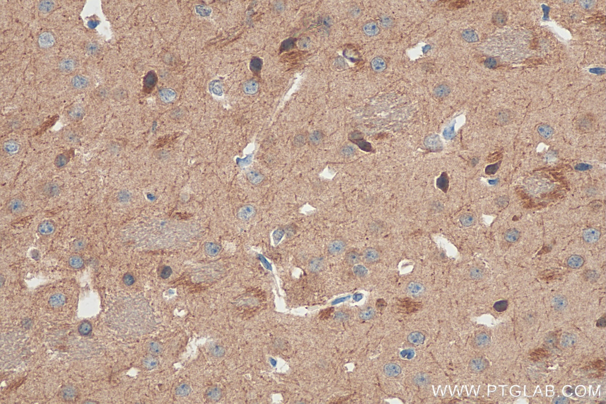 Immunohistochemistry (IHC) staining of mouse brain tissue using Cannabinoid receptor 1 Polyclonal antibody (17978-1-AP)