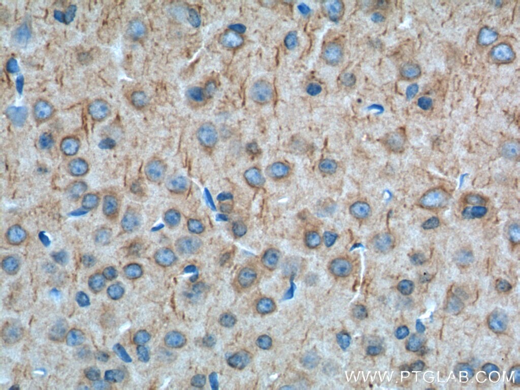 Cannabinoid receptor 1 Polyclonal antibody