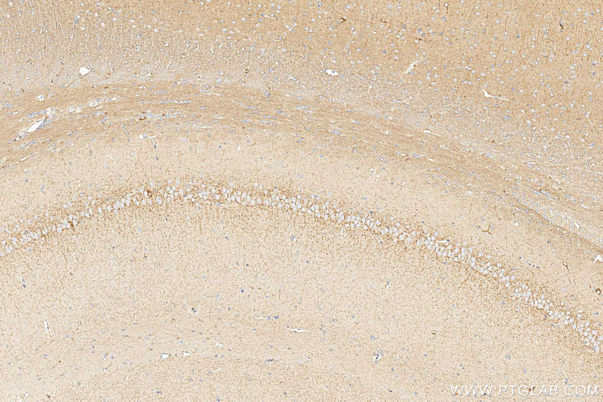 IHC staining of rat brain using 17978-1-AP Immunohistochemistry (IHC) staining of rat brain tissue using Cannabinoid receptor 1 Polyclonal antibody (17978-1-AP)
