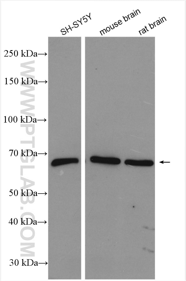 Western Blot (WB) analysis of various lysates using Cannabinoid receptor 1 Polyclonal antibody (17978-1-AP)