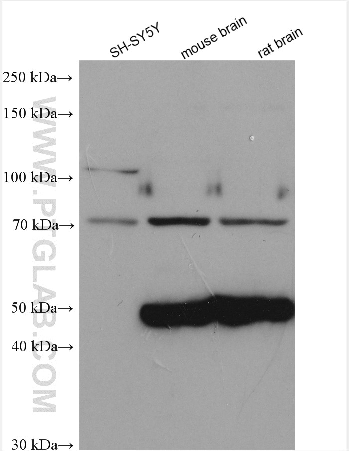 Western Blot (WB) analysis of various lysates using Cannabinoid receptor 1 Polyclonal antibody (17978-1-AP)