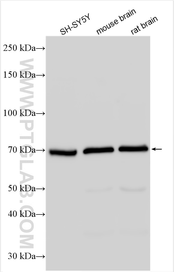 Western Blot (WB) analysis of various lysates using Cannabinoid receptor 1 Polyclonal antibody (17978-1-AP)