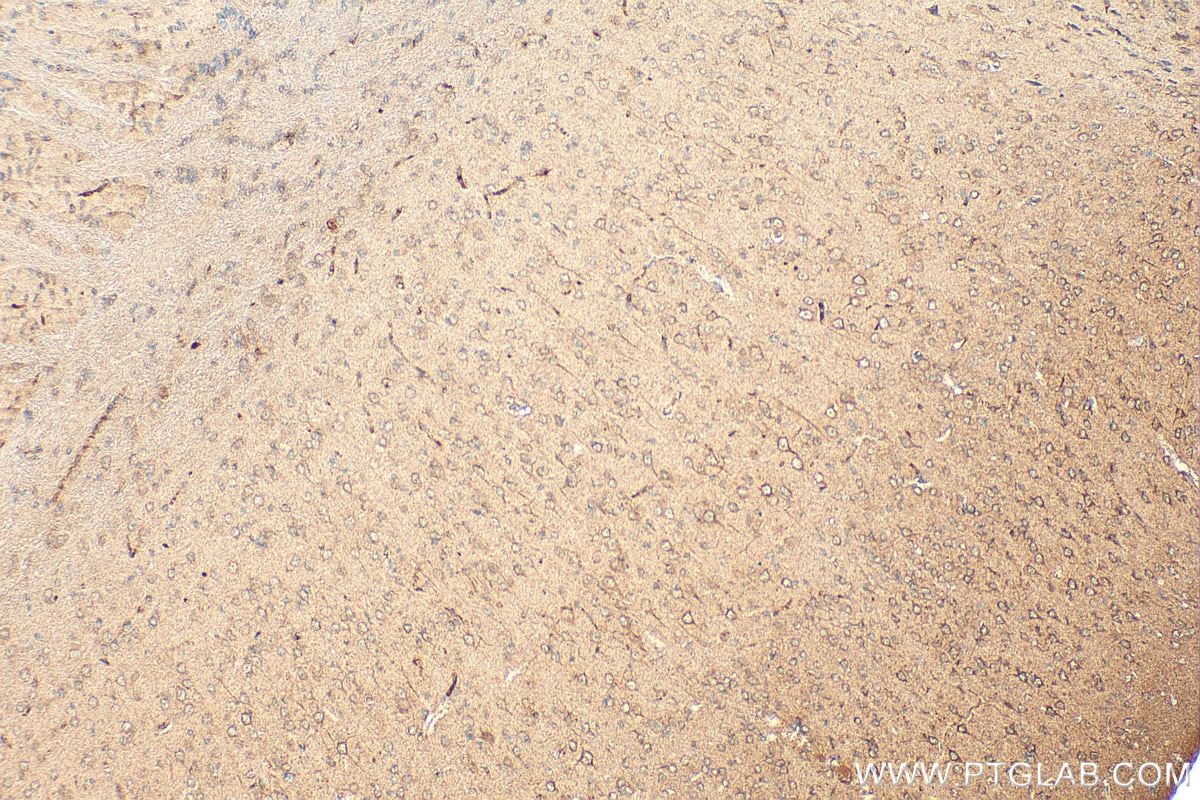 Immunohistochemical analysis of paraffin-embedded mouse brain tissue slide using 29708-1-AP (Cannabinoid receptor 1 antibody) at dilution of 1:1000 (under 10x lens). Heat mediated antigen retrieval with Tris-EDTA buffer (pH 9.0). Immunohistochemistry (IHC) staining of mouse brain tissue using Cannabinoid receptor 1 Polyclonal antibody (29708-1-AP)