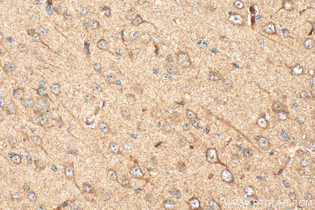 Immunohistochemical analysis of paraffin-embedded mouse brain tissue slide using 29708-1-AP (Cannabinoid receptor 1 antibody) at dilution of 1:1000 (under 40x lens). Heat mediated antigen retrieval with Tris-EDTA buffer (pH 9.0). Immunohistochemistry (IHC) staining of mouse brain tissue using Cannabinoid receptor 1 Polyclonal antibody (29708-1-AP)