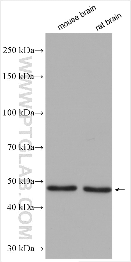 Western Blot (WB) analysis of various lysates using Cannabinoid receptor 1 Polyclonal antibody (29708-1-AP)