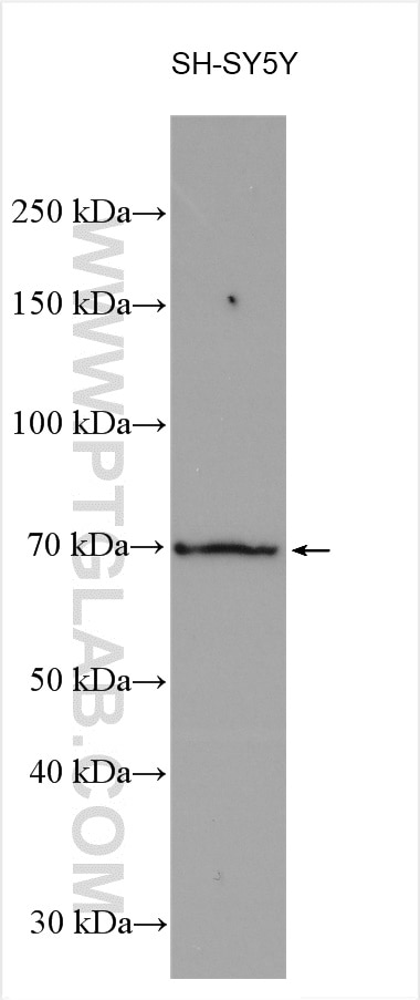 WB analysis using 29708-1-AP