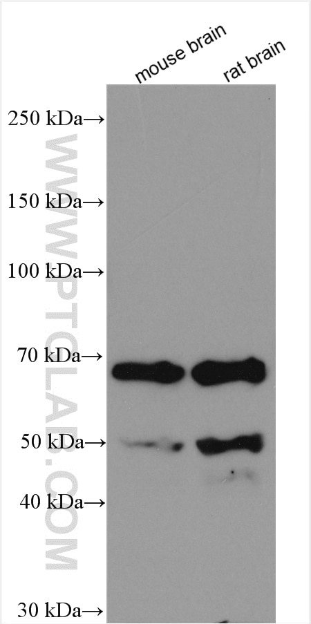 Western Blot (WB) analysis of various lysates using Cannabinoid receptor 1 Polyclonal antibody (29708-1-AP)