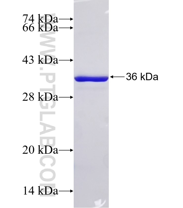 CNR1 fusion protein Ag31838 SDS-PAGE