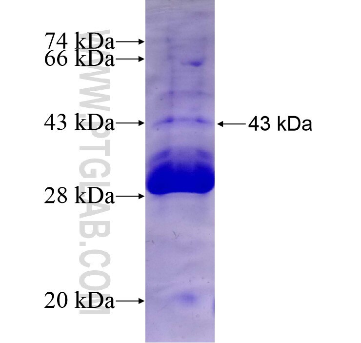 CNR2 fusion protein Ag13685 SDS-PAGE