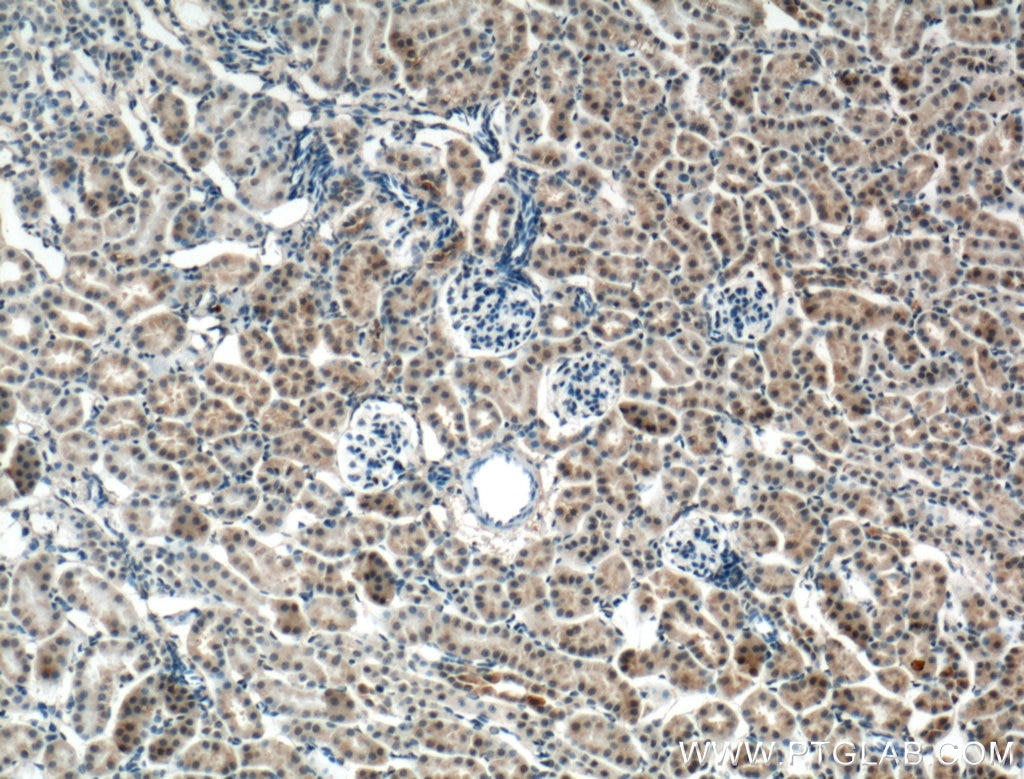 Immunohistochemistry (IHC) staining of mouse kidney tissue using CNRIP1 Polyclonal antibody (16827-1-AP)