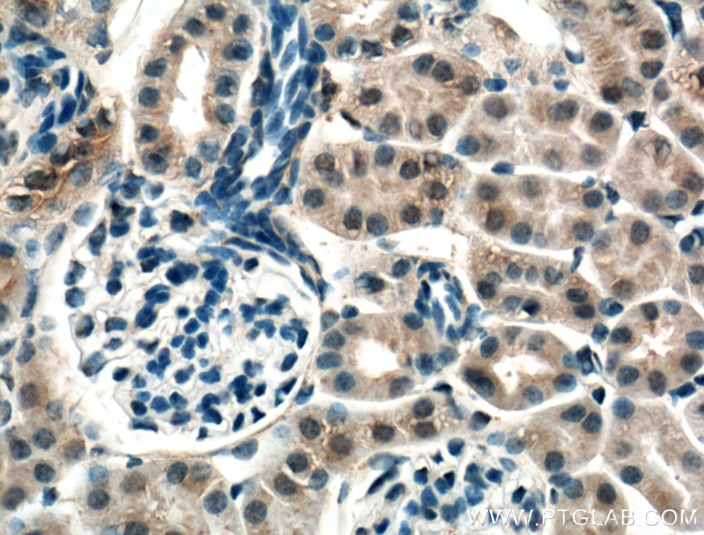 Immunohistochemistry (IHC) staining of mouse kidney tissue using CNRIP1 Polyclonal antibody (16827-1-AP)