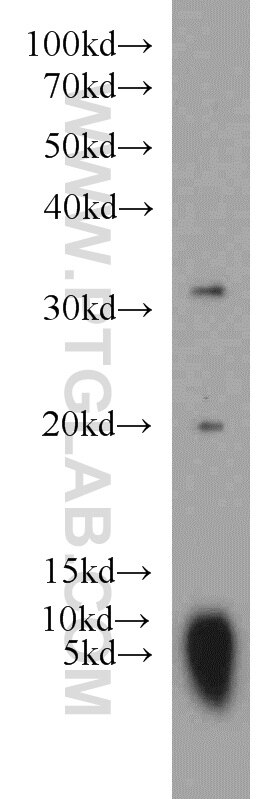 Western Blot (WB) analysis of rat brain tissue using CNRIP1 Polyclonal antibody (16827-1-AP)