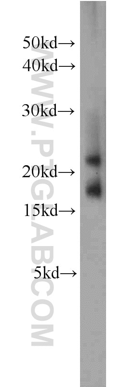 Western Blot (WB) analysis of human brain tissue using CNRIP1 Polyclonal antibody (16827-1-AP)