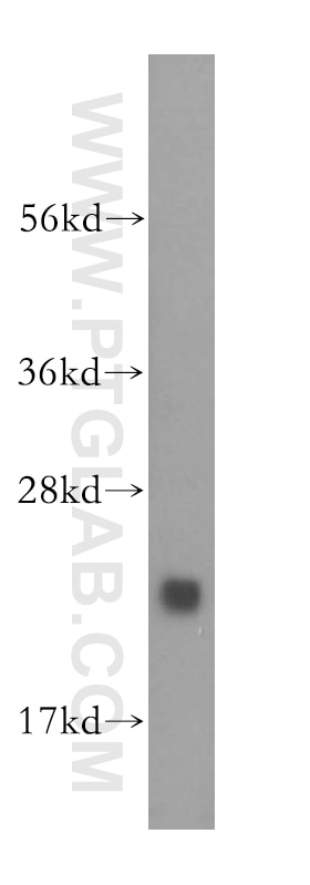 Western Blot (WB) analysis of human brain tissue using CNRIP1 Polyclonal antibody (16827-1-AP)