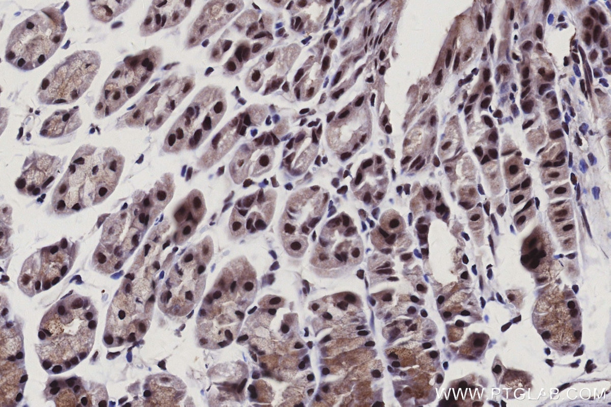 Immunohistochemistry (IHC) staining of mouse stomach tissue using CNTD1 Polyclonal antibody (24854-1-AP)
