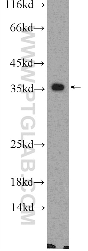 Western Blot (WB) analysis of mouse colon tissue using CNTD1 Polyclonal antibody (24854-1-AP)