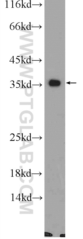 WB analysis of mouse colon using 24854-1-AP