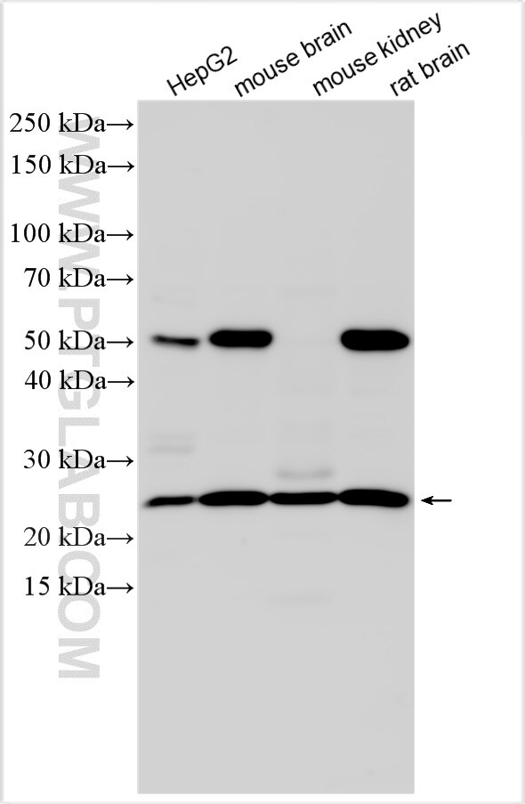 Western Blot (WB) analysis of various lysates using CNTD2 Polyclonal antibody (31588-1-AP)