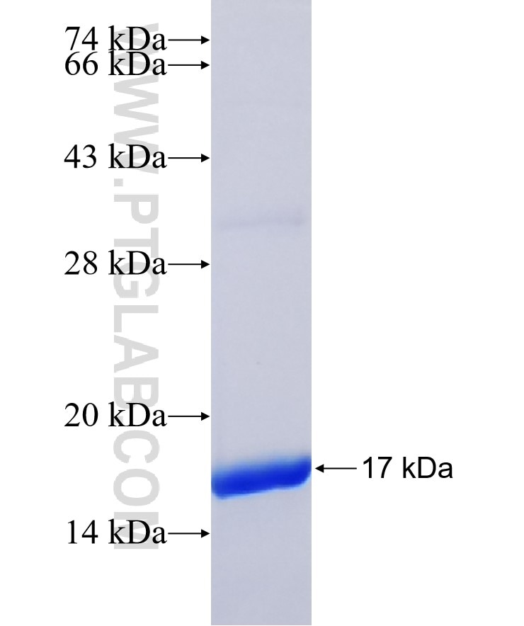 CNTD2 fusion protein Ag36441 SDS-PAGE CNTD2 fusion protein Ag36441 SDS-PAGE