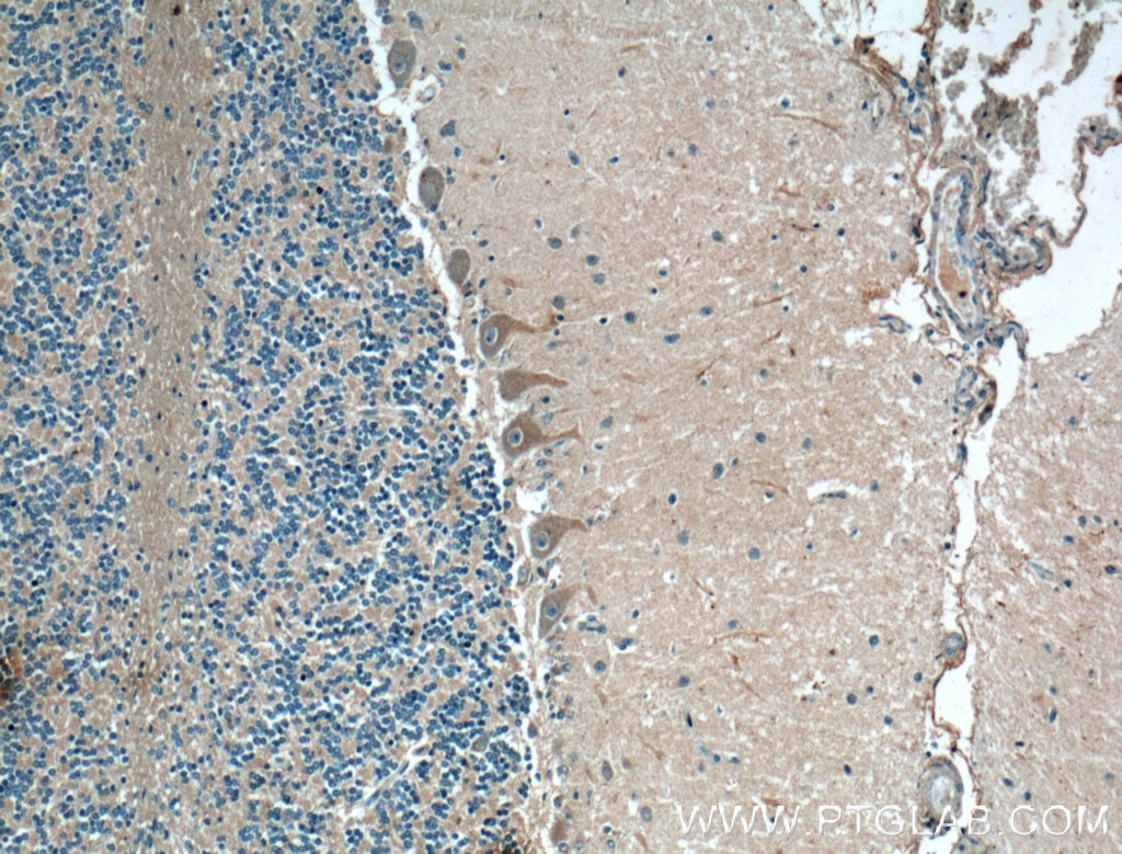 Immunohistochemistry (IHC) staining of human cerebellum tissue using CNTF Polyclonal antibody (27342-1-AP)