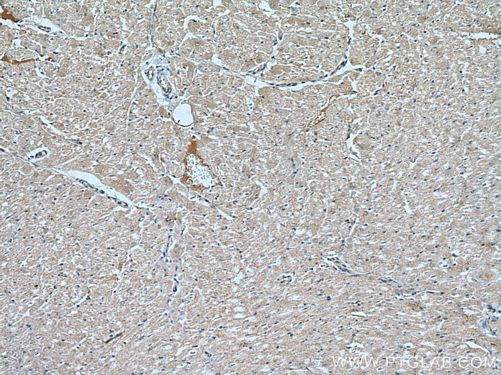 IHC staining of human heart using 10796-1-AP