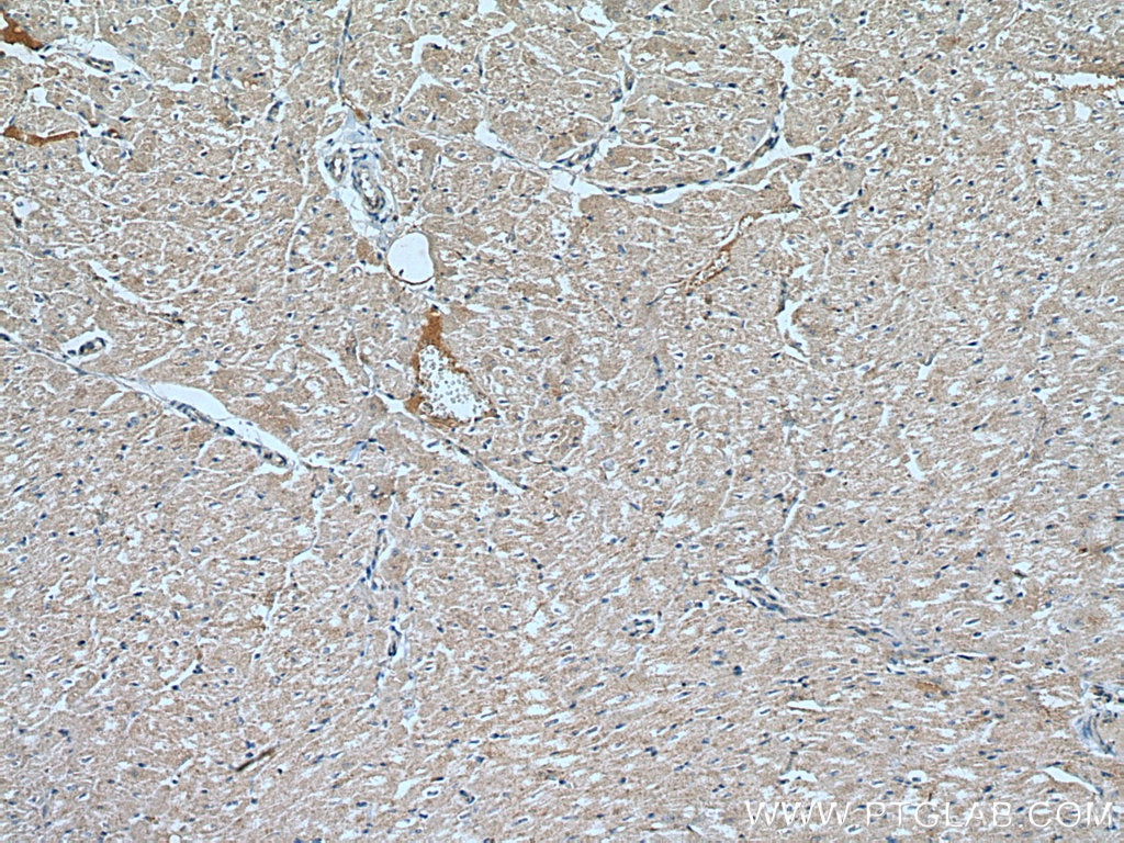 Immunohistochemistry (IHC) staining of human heart tissue using CNTFR Polyclonal antibody (10796-1-AP)