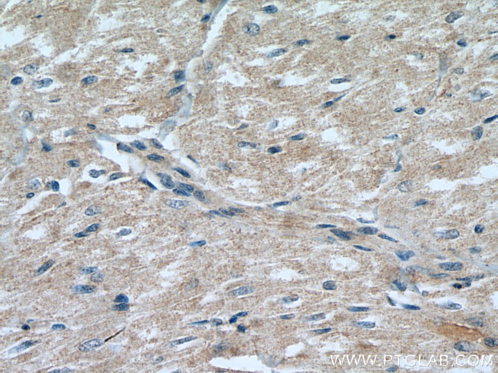 Immunohistochemistry (IHC) staining of human heart tissue using CNTFR Polyclonal antibody (10796-1-AP)