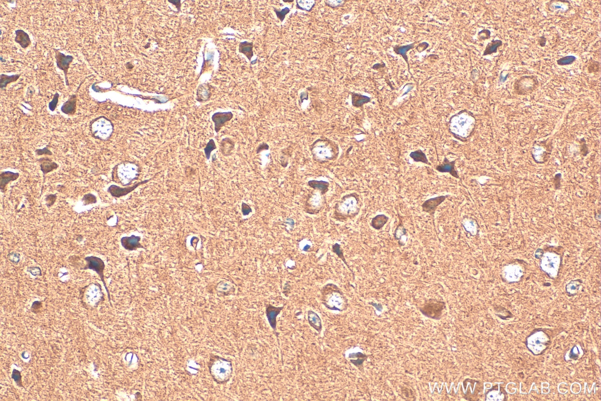 Immunohistochemistry (IHC) staining of mouse brain tissue using CNTFR Polyclonal antibody (10796-1-AP)