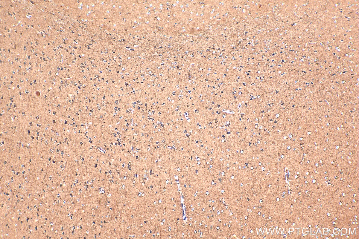 Immunohistochemistry (IHC) staining of mouse brain tissue using CNTFR Polyclonal antibody (10796-1-AP)