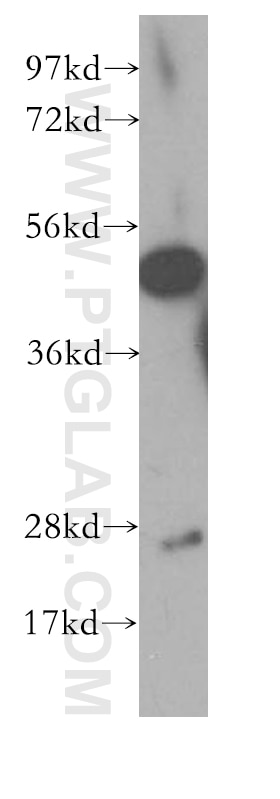 Western Blot (WB) analysis of human brain tissue using CNTFR Polyclonal antibody (10796-1-AP)