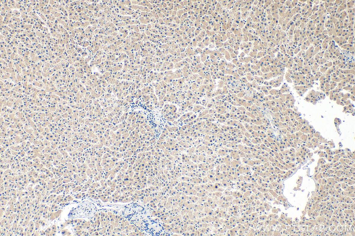 Immunohistochemistry (IHC) staining of human liver tissue using CNTLN Polyclonal antibody (31698-1-AP)