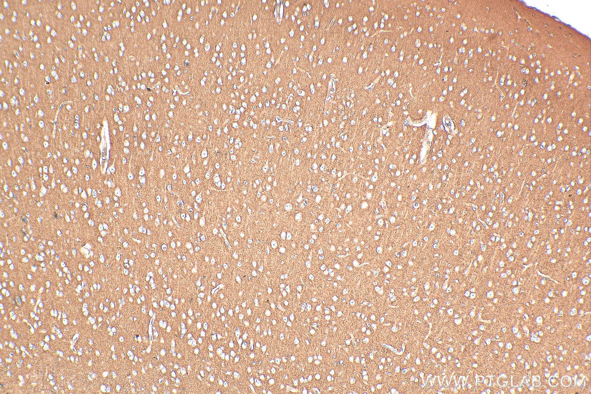 Immunohistochemistry (IHC) staining of mouse brain tissue using CNTN1 Polyclonal antibody (13843-1-AP)