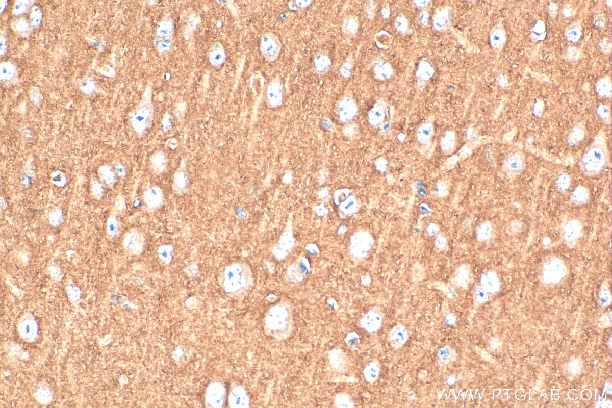 IHC staining of mouse brain using 13843-1-AP